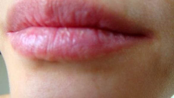 Αμυγδαλέλαιο: Μια πανεύκολη συνταγή-βάλσαμο για τα σκασμένα χείλη σας