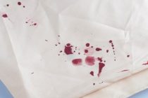 Λεκέδες από αίμα; Μπορείς να τους ξεφορτωθείς με το πιο φυσικό καθαριστικό