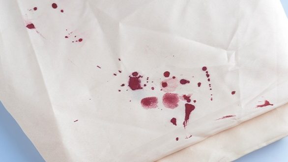 Λεκέδες από αίμα; Μπορείς να τους ξεφορτωθείς με το πιο φυσικό καθαριστικό
