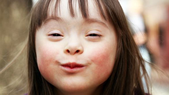 Παγκόσμια Ημέρα για το Σύνδρομο Down