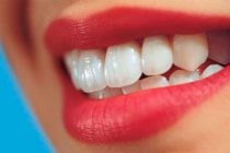 Πώς να αποκτήσεις πιο λευκά δόντια με φυσικό τρόπο. Είναι πανεύκολο!