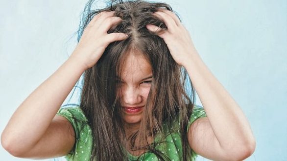 Πως να αντιμετωπίσετε τις ψείρες