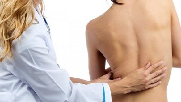 Σκολίωση: Από τι δημιουργείται και πως γίνεται η διάγνωση;