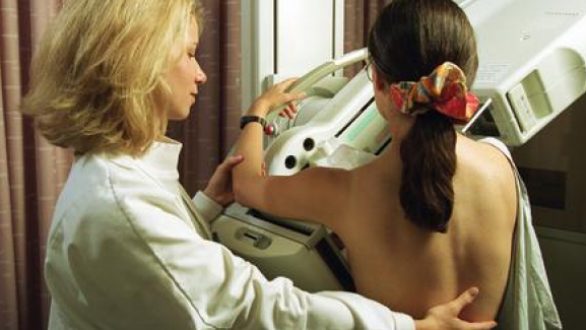 Εστάλησαν τα πρώτα SMS για δωρεάν μαστογραφία στις νέες ηλικιακές ομάδες δικαιούχων