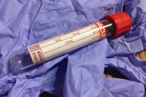 Αυτές είναι οι top-3 τροφές για καλύτερη κυκλοφορία του αίματος