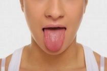 Οι τρεις βασικές επιπτώσεις αν δεν βουρτσίζετε τη γλώσσα σας