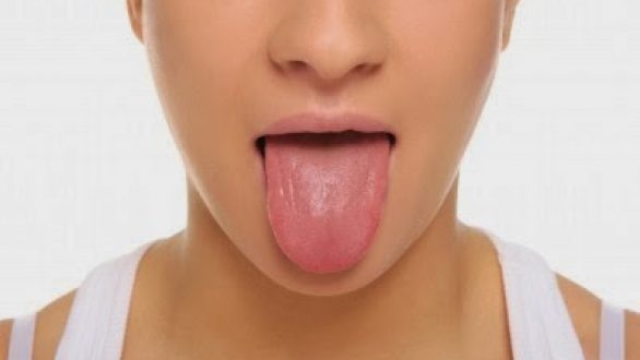 Οι τρεις βασικές επιπτώσεις αν δεν βουρτσίζετε τη γλώσσα σας