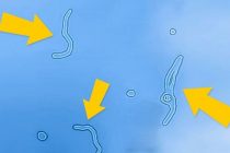 Τι είναι αυτά τα σημάδια που καμιά φορά… αιωρούνται στα μάτια σας