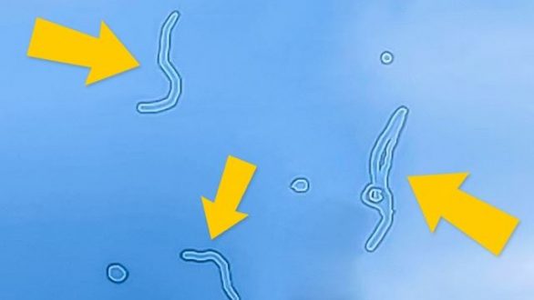 Τι είναι αυτά τα σημάδια που καμιά φορά… αιωρούνται στα μάτια σας