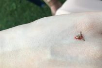 Κουνούπια: Το κόλπο πριν βγείτε έξω για να μην σας τσιμπάνε