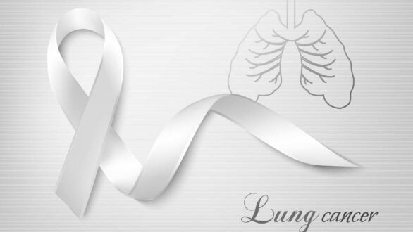 Στα λευκά το δημαρχείο Αλεξανδρούπολης για την πρόληψη του καρκίνου του πνεύμονα