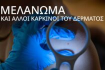 Ημερίδα «Μελάνωμα και άλλοι καρκίνοι του δέρματος» στην Αλεξανδρούπολη