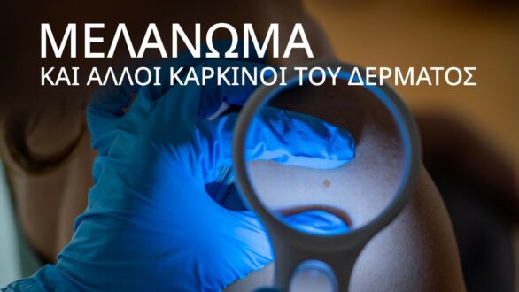 Ημερίδα «Μελάνωμα και άλλοι καρκίνοι του δέρματος» στην Αλεξανδρούπολη