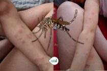 Βενετίδης για τα κουνούπια στον Έβρο: “Δεν μας άφησαν να χρησιμοποιήσουμε το μοναδικό μας όπλο εγκαίρως”