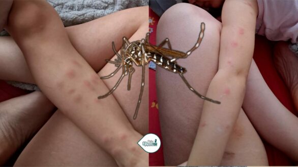 Βενετίδης για τα κουνούπια στον Έβρο: “Δεν μας άφησαν να χρησιμοποιήσουμε το μοναδικό μας όπλο εγκαίρως”