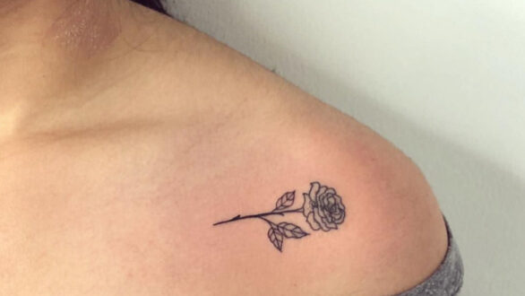 Όλα όσα πρέπει να ξέρεις για το tattooremoval& για το tattooremovalbefore & after